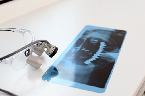 loupes allow for focused examination of the mouth