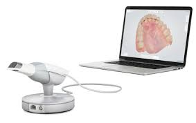 Trios Intraoral Scanner can be used in taking dental impressions
