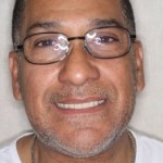 After Full Mouth Restoration