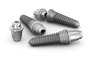 diagram of implants pre procedure