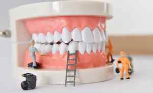 set of dentures surrounded by toy repairmen