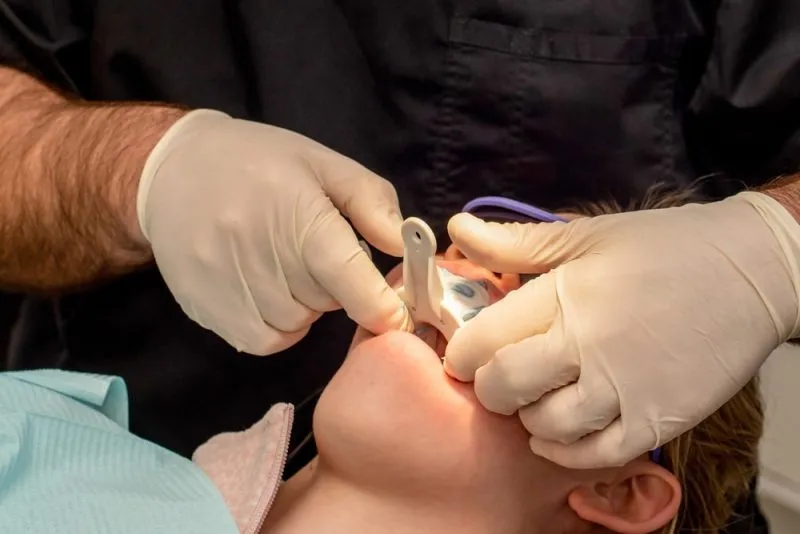 Dentist making teeth impression mold