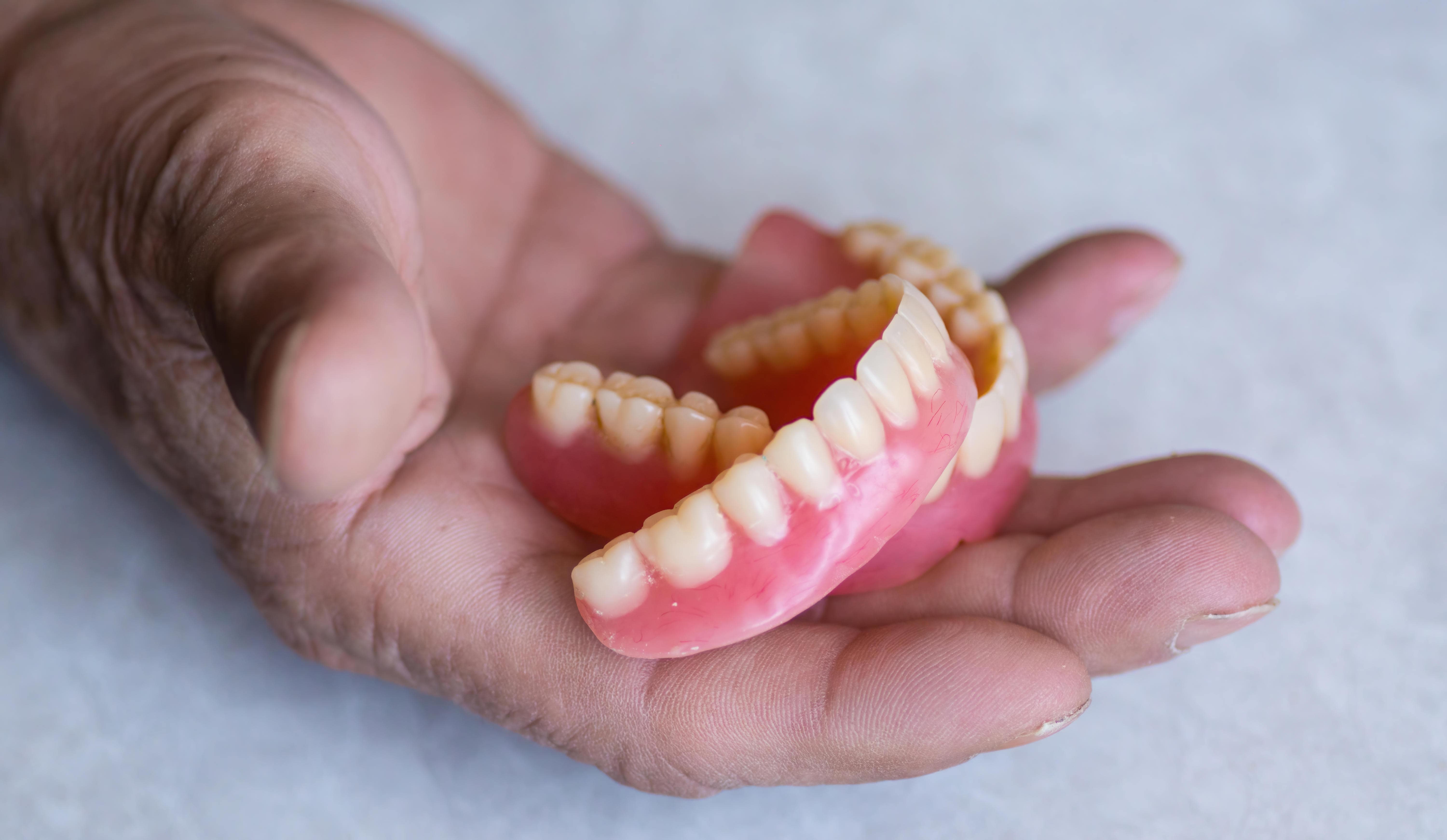 senior citizen holding upper dentures set