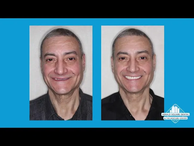 Are Dentures Right For Me?