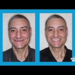 Are Dentures Right For Me?