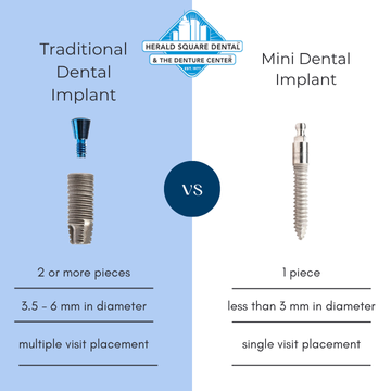 Mini Dental Implants NYC | Herald Square Dental